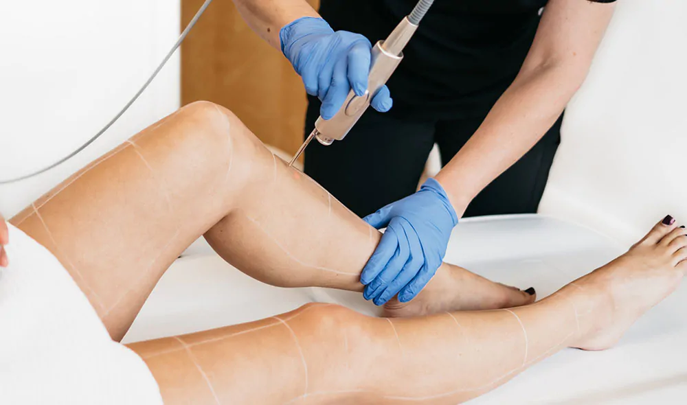 Laser Hair Removal